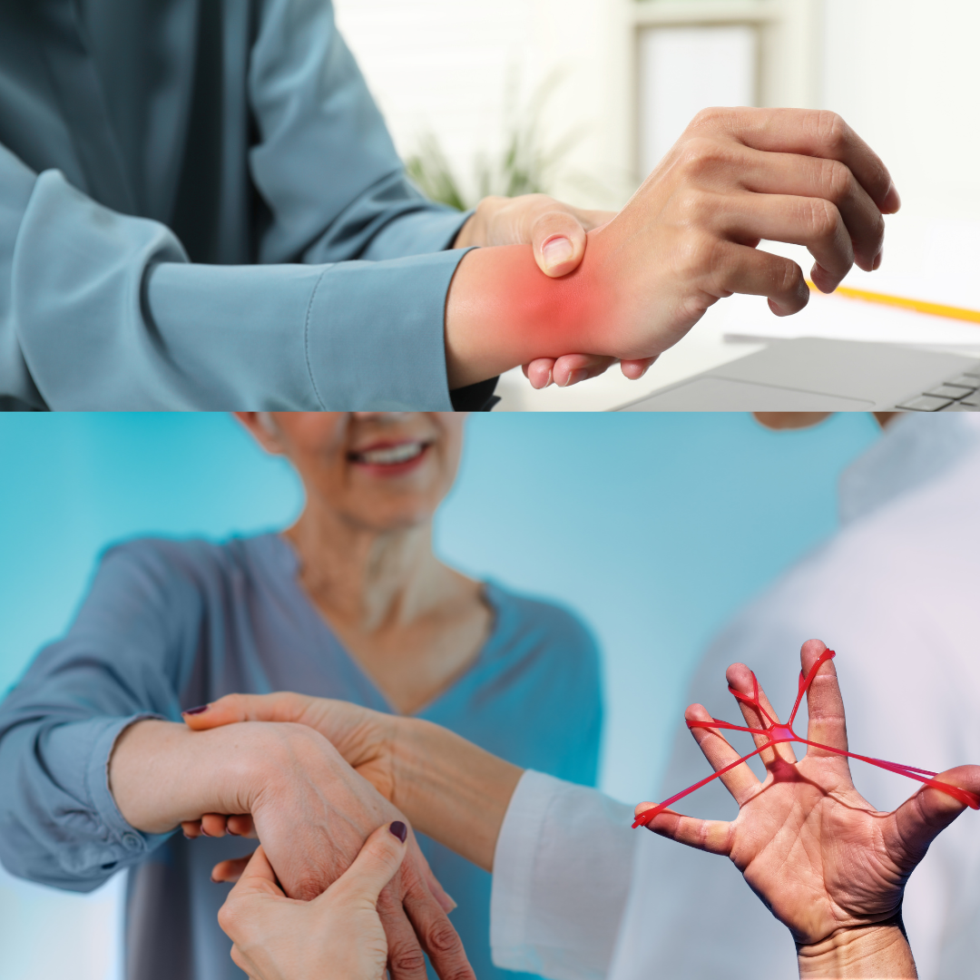 Comparison of carpal tunnel wrist pain and therapeutic hand exercises for post-surgery rehabilitation.